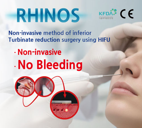 Korea's First Rhinitis Treatment Device 'RHINOS'